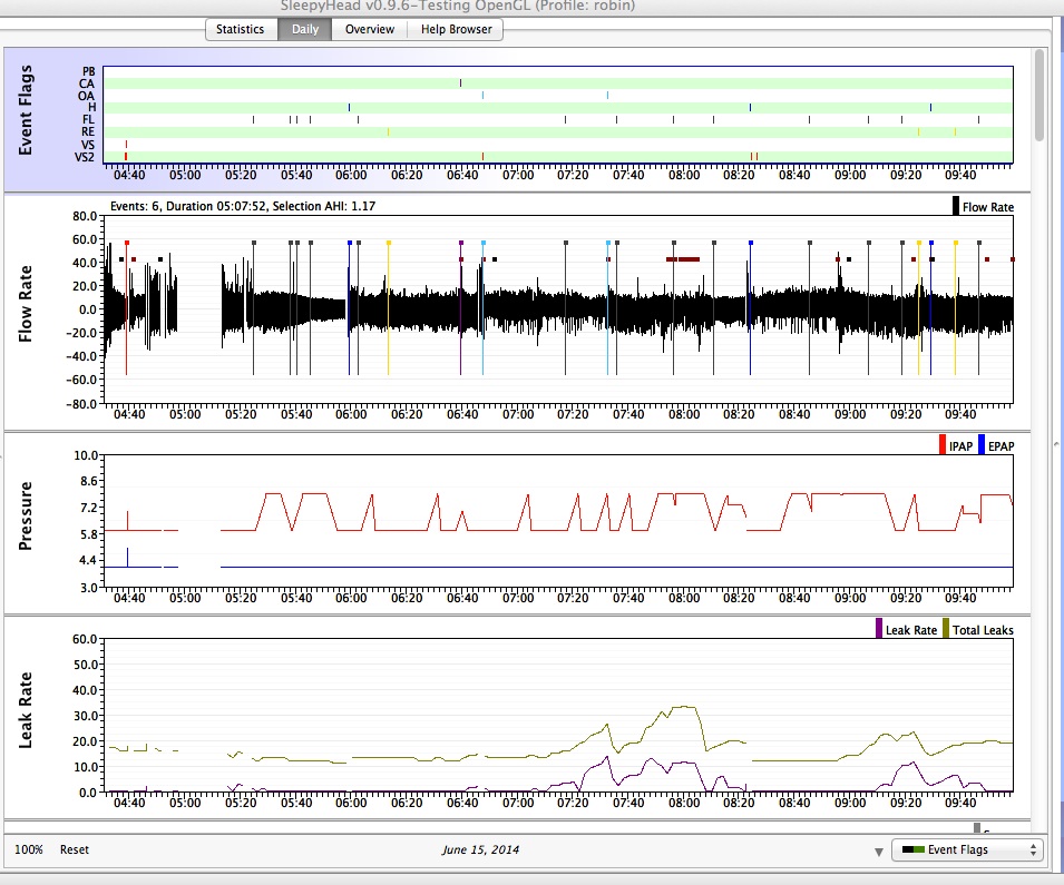 Daily-graphs zpscf0763d4.jpg