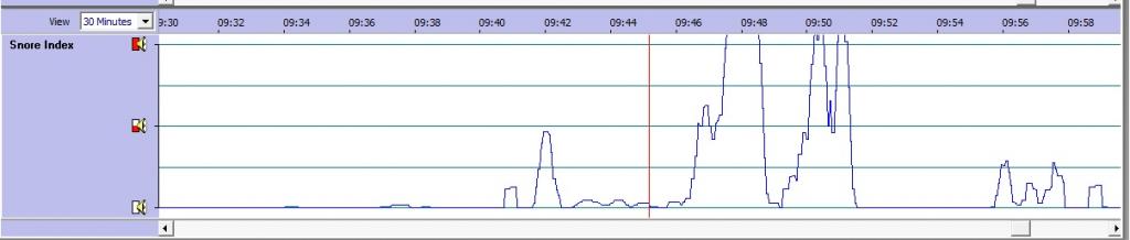 Snore-graph-ResScan zpsfabebf0a.jpg