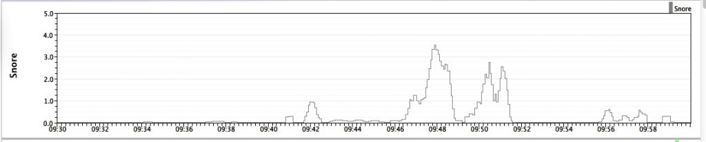 Snore-graph-sleepyhead zpsa57203b2.jpg