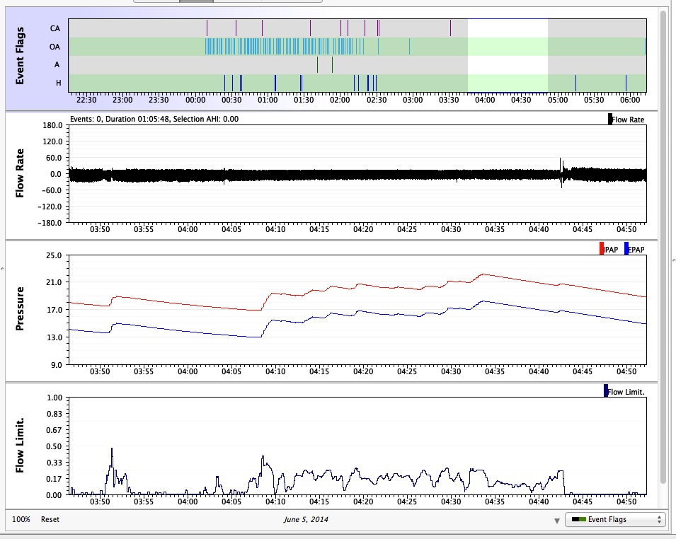 Pressure increases zps4dbeba44.jpg