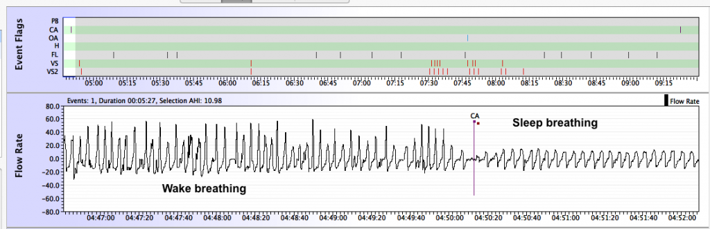 Sleep transition central zpscab10ed3.png