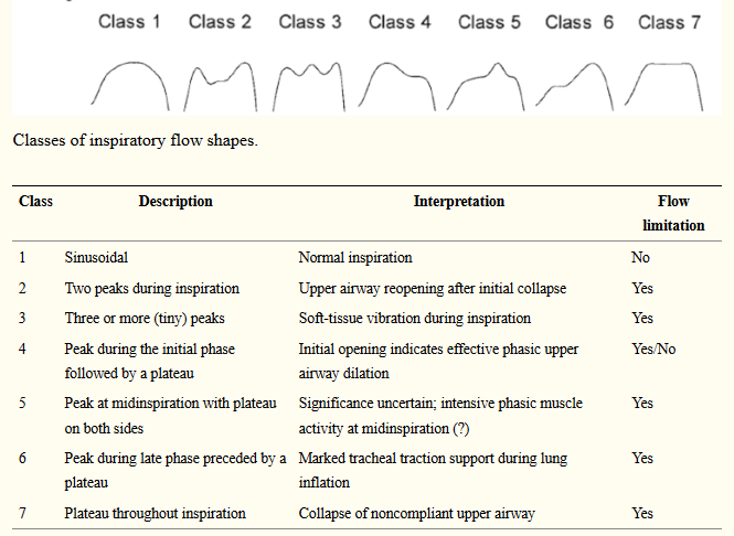 [Image: Flowlimitations_Classes.png]