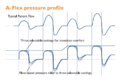 A-Flex Pressure Profile.PNG
