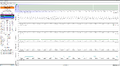 Cardiogenic Oscillation.png