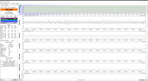 Cardiogenic Oscillation.png