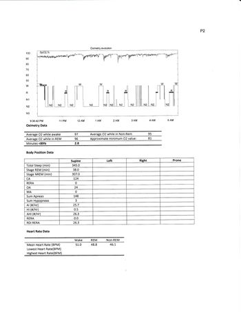 SD-Bipap-Study-ASV-Justify-pg2.jpg