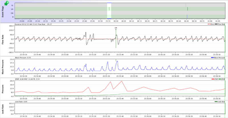 ASV Mask Pressure - ResMed.png