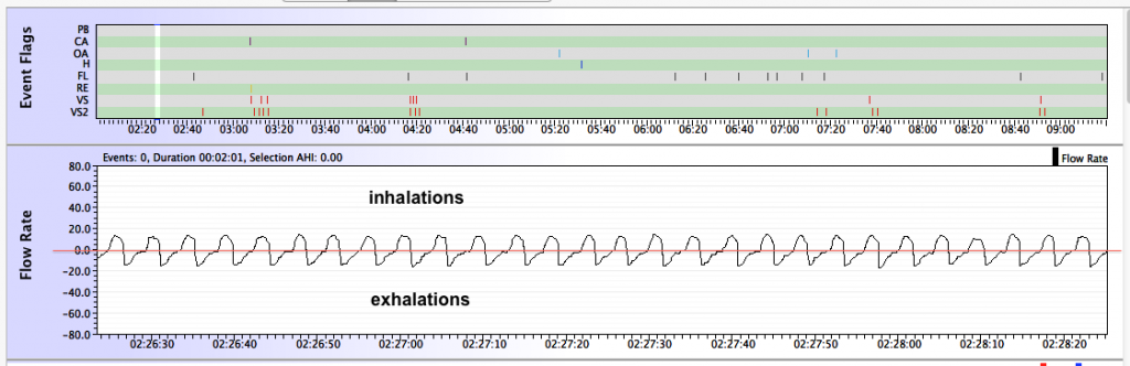 Wave-flow1 zpse082659a.png