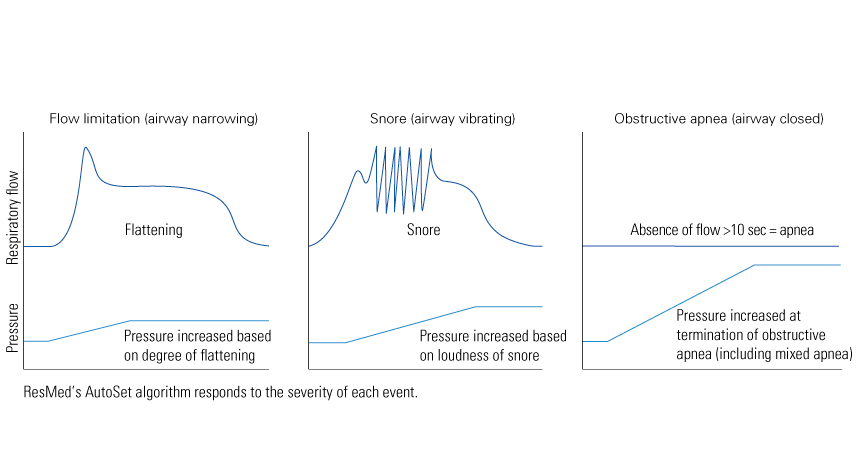 AutoSet Technology graph.png