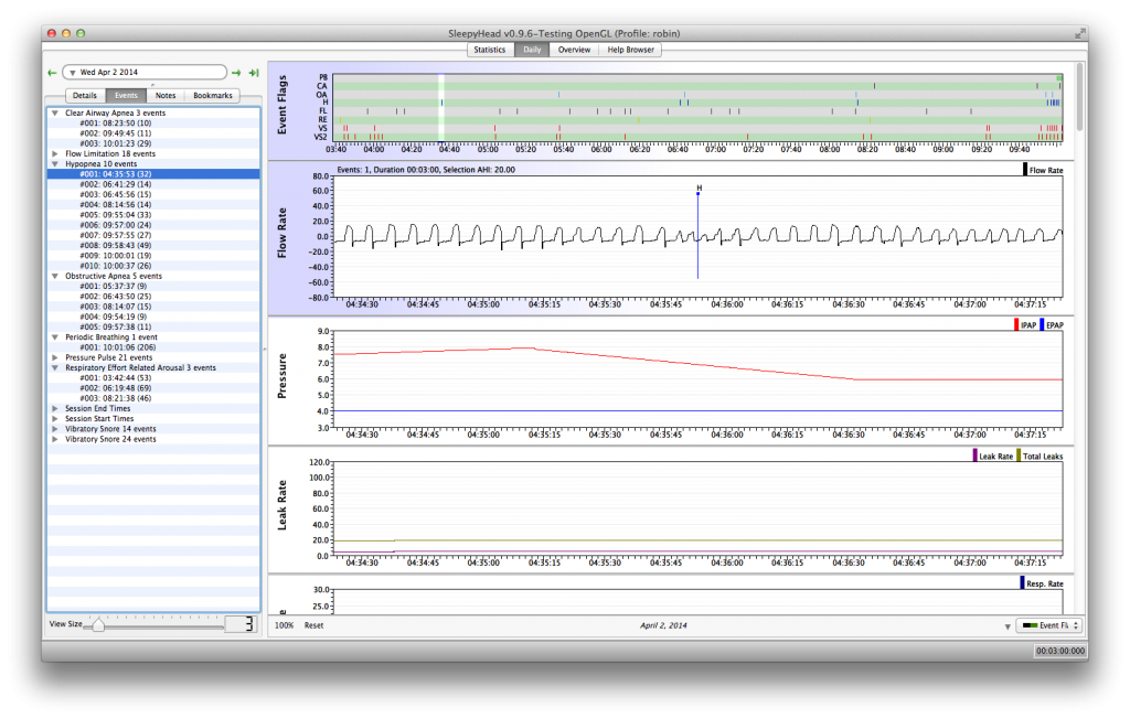 Hypopnea close up zpsfd54c12a.png