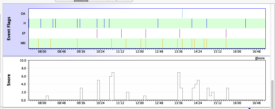 Snore-Intellipap zps90834ece.png