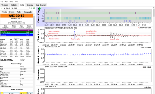 Severe Positional Apnea FL Closeup.png